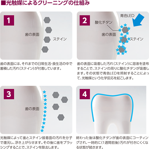 クリーニングの仕組み